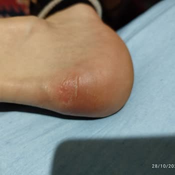 Puma RS X Ayakkabı İle Sürekli Yaşanan Sorunlar