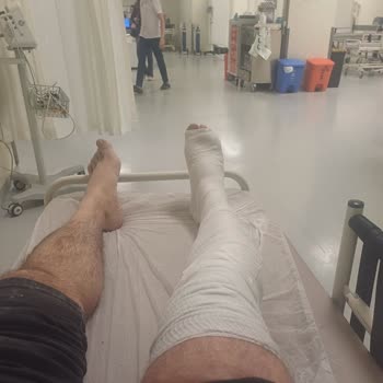 Honda Dio Motosiklet Lastik Sorunu: Güvenlik Tehlikesi