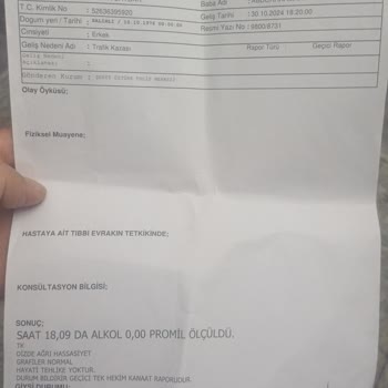 Honda Dio Motosiklet Lastik Sorunu: Güvenlik Tehlikesi