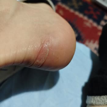 Puma Ayakkabı Vurması Ve Kalite Sorunları