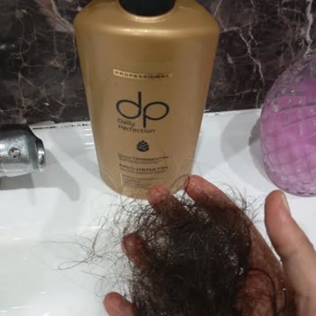 Çam Terebentin Kullanımı Sonrası Saç Dökülmesi Problemi