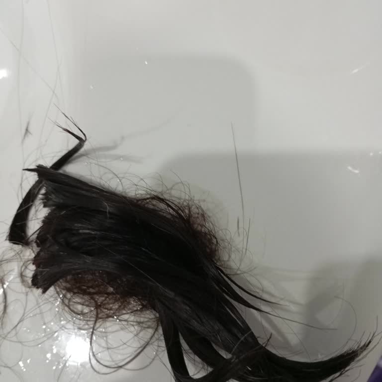 Çam Terebentin Kullanımı Sonrası Saç Dökülmesi Problemi