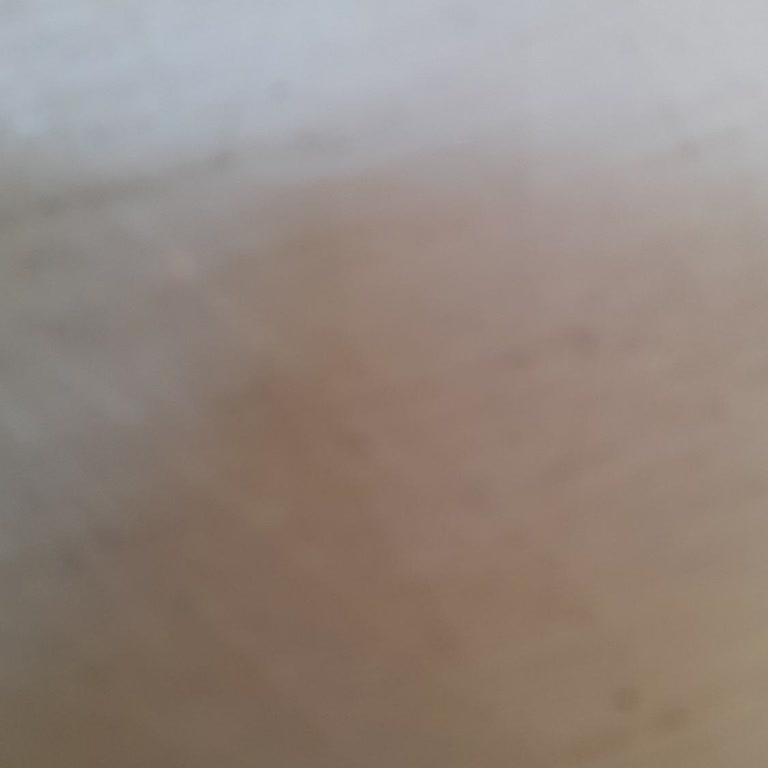 Renault Servisinde Geciken Cam Değişimi