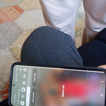 Samsung Telefonumda Kalıcı Beyaz Çizgi Sorunu