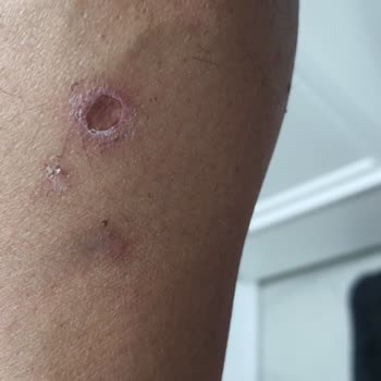 Enza Altınkum Şubesi: Yanıklar Ve İade Sorunu