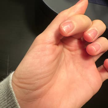 Ary Beauty Center Kötü Deneyim