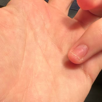 Ary Beauty Center Kötü Deneyim