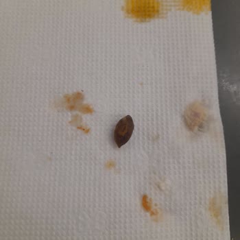 Sbarro Pizza'da Zeytin Çekirdeği: Oğlumun Dişi Zarar Gördü