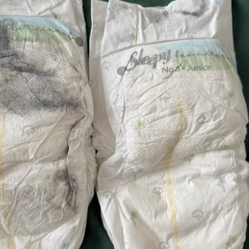 Sleepy Bebek Bezinde Beklenmedik Lekeler