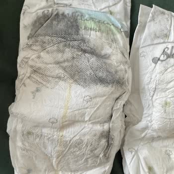 Sleepy Bebek Bezinde Beklenmedik Lekeler