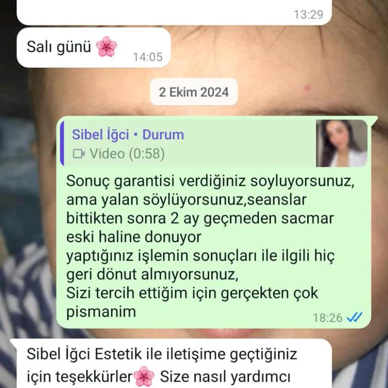 Saç Tedavisi Sonrası Hayal Kırıklığı