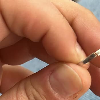 Tektaş Pırlanta Yüzükte Sürekli Kırılma Ve Yetersiz Hizmet