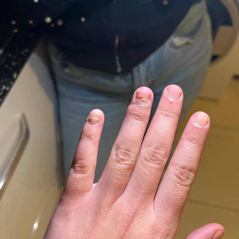 Hastanede İlgisizlik Ve Tedavi Eksikliği