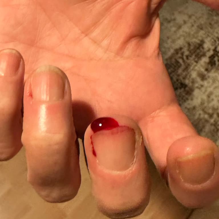 Ayakkabıda Çivi Şoku: Tehlikeli Alışveriş Deneyimi