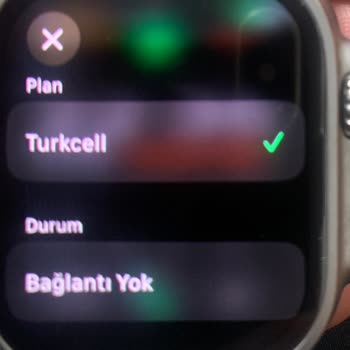 Turkcell Cellular Aboneliği Sorunu: Apple Watch Bağlantı Problemi