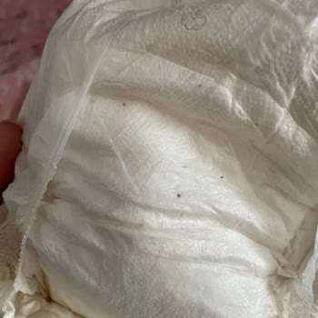 Bebek Bezi Üzerindeki Gizemli Lekeler