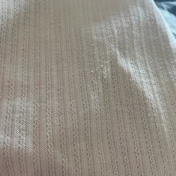 Tüylenen Ürün İçin İade Sorunu