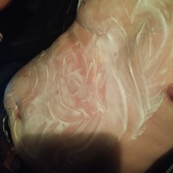 Hatalı Kahve Kapakları İle Yaşanan Yanık Sorunu