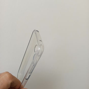 Xiaomi Şeffaf Kılıfın Hızla Sararması Üzdü