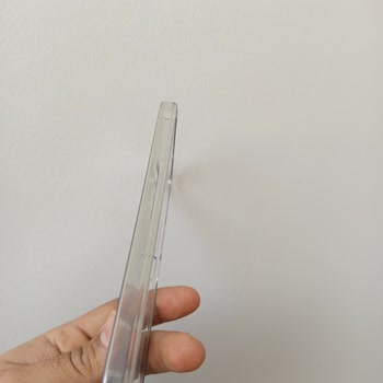 Xiaomi Şeffaf Kılıfın Hızla Sararması Üzdü