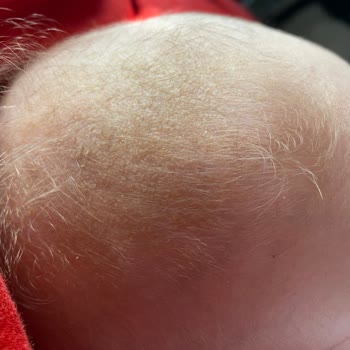 Mustela Bebek Şampuanı Ve Konak Sorunu