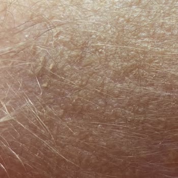 Mustela Bebek Şampuanı Ve Konak Sorunu