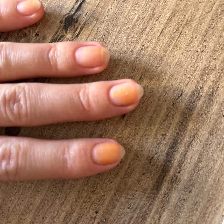 Flormar Oje Renk Değiştirme Sorunu