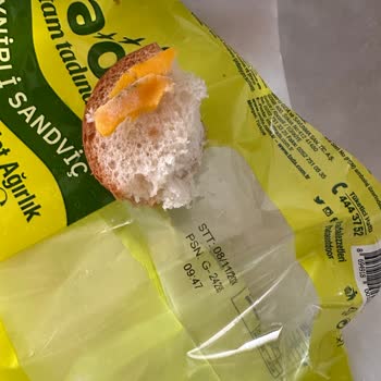 Küflü Sandviç Sebebiyle Sağlık Sorunları Yaşadım