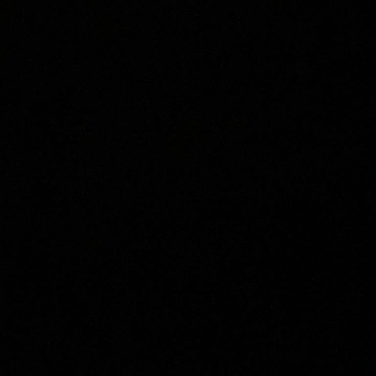 Anadolu Sigorta'dan Kasko Ödemesi Sorunu