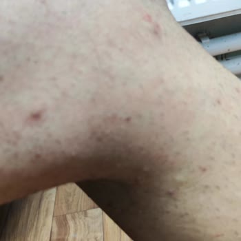 Taşeron Firma İle Yaşanan Hakaret Ve Hak Kaybı Sorunu