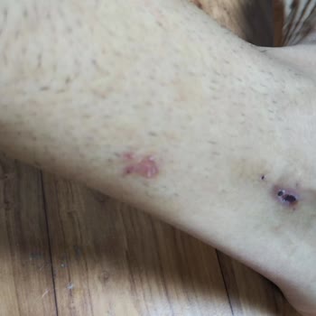 Taşeron Firma İle Yaşanan Hakaret Ve Hak Kaybı Sorunu