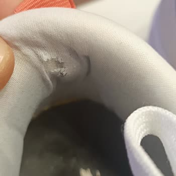 Adidas Ayakkabıda Garanti Sorunu Ve Yırtılma Problemi