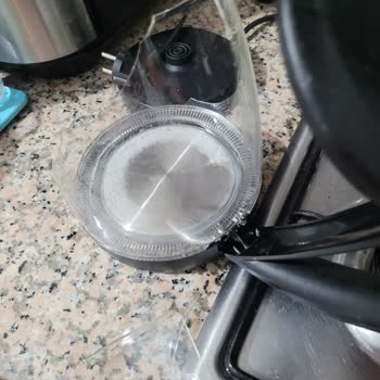 Kalitesiz Ürün Ciddi Yanık Kazasına Sebep Oldu