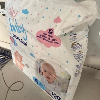 Tahriş Eden Ve Sızdıran Bebek Bezi Sorunu