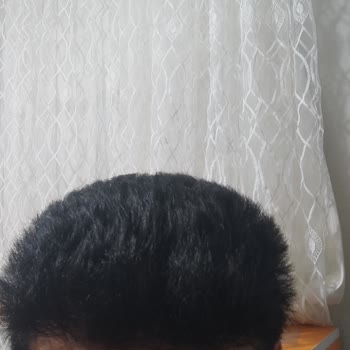 Cilt Ürününde Beklenmedik Yan Etkiler