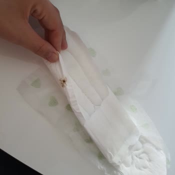 Molped Ped İçinden Böcek Çıktı: Şok Edici Deneyim