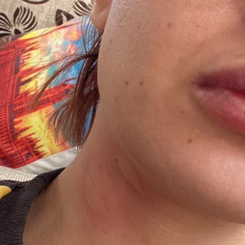 Cappy Meyve Suyu Kapağı Patladı: Tehlike Saçıyor