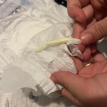 Bebek Bezinde Tehlikeli Plastik Parça