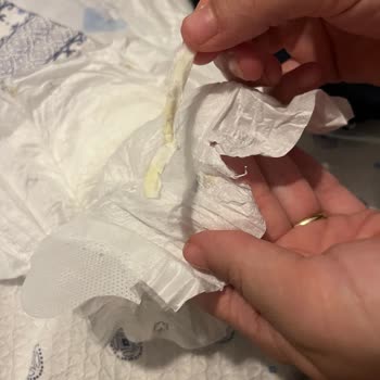 Bebek Bezinde Tehlikeli Plastik Parça