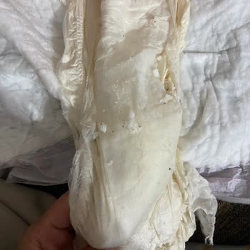 Bebek Bezindeki Parçacıklar Ve Küf Kokusu Endişelendiriyor