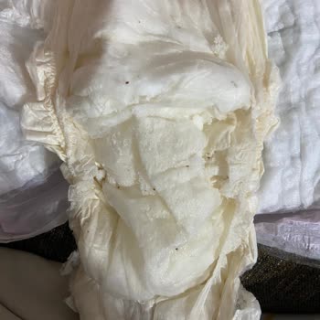 Bebek Bezindeki Parçacıklar Ve Küf Kokusu Endişelendiriyor