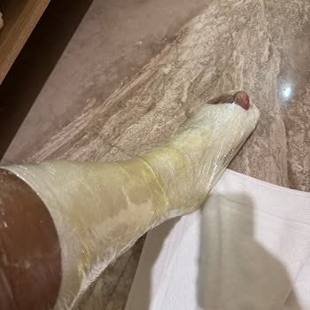 Swiss Otel'de Güvenlik İhmali: Hayatımı Tehlikeye Attı