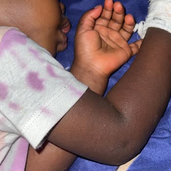 Sebamed Baby Product Caused Severe Skin Reaction Requiring Hospital Visit