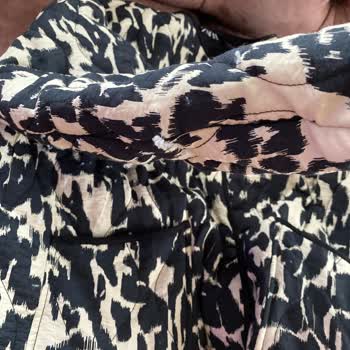 Zara Ceketinde Beklenmedik Kalite Sorunları