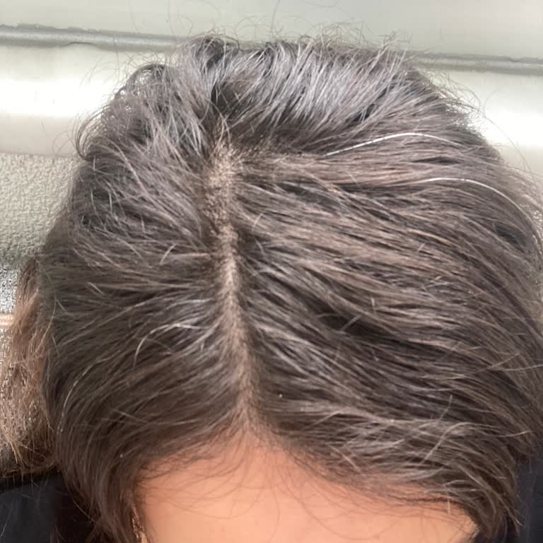 Saç Beyazlatan Ürün Şoku