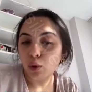 Dalin Bebek Masaj Yağı Alerji Yaptı!