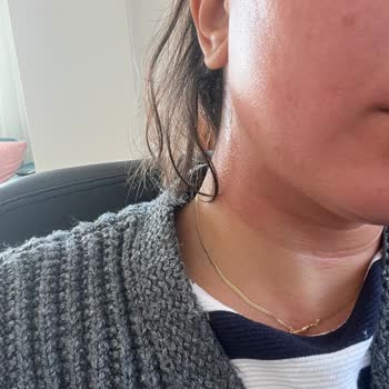 Bee Beauty Pirinç Maskesi Ciltte Kızarıklık Ve Yanma Yaptı