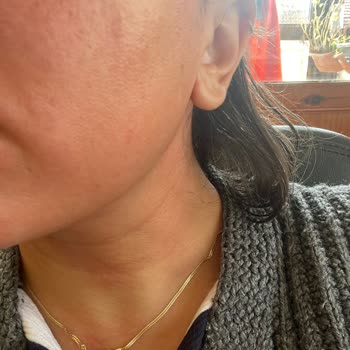 Bee Beauty Pirinç Maskesi Ciltte Kızarıklık Ve Yanma Yaptı