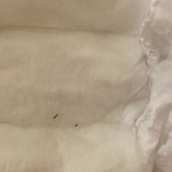 Bebek Bezinde Tehlikeli Yabancı Cisim Şoku