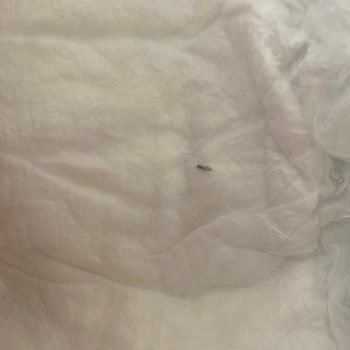 Bebek Bezinde Tehlikeli Yabancı Cisim Şoku